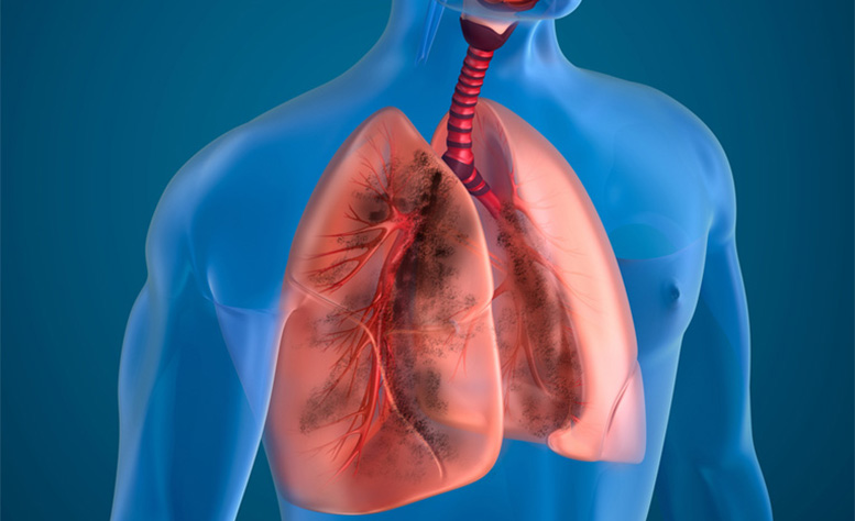 Consult Dr. Manoj Maske: Best Pulmonologist & Lung Disease Specialist in Thane West, Mumbai, offering best treatment for lungs related diseases in Thane Mumbai.